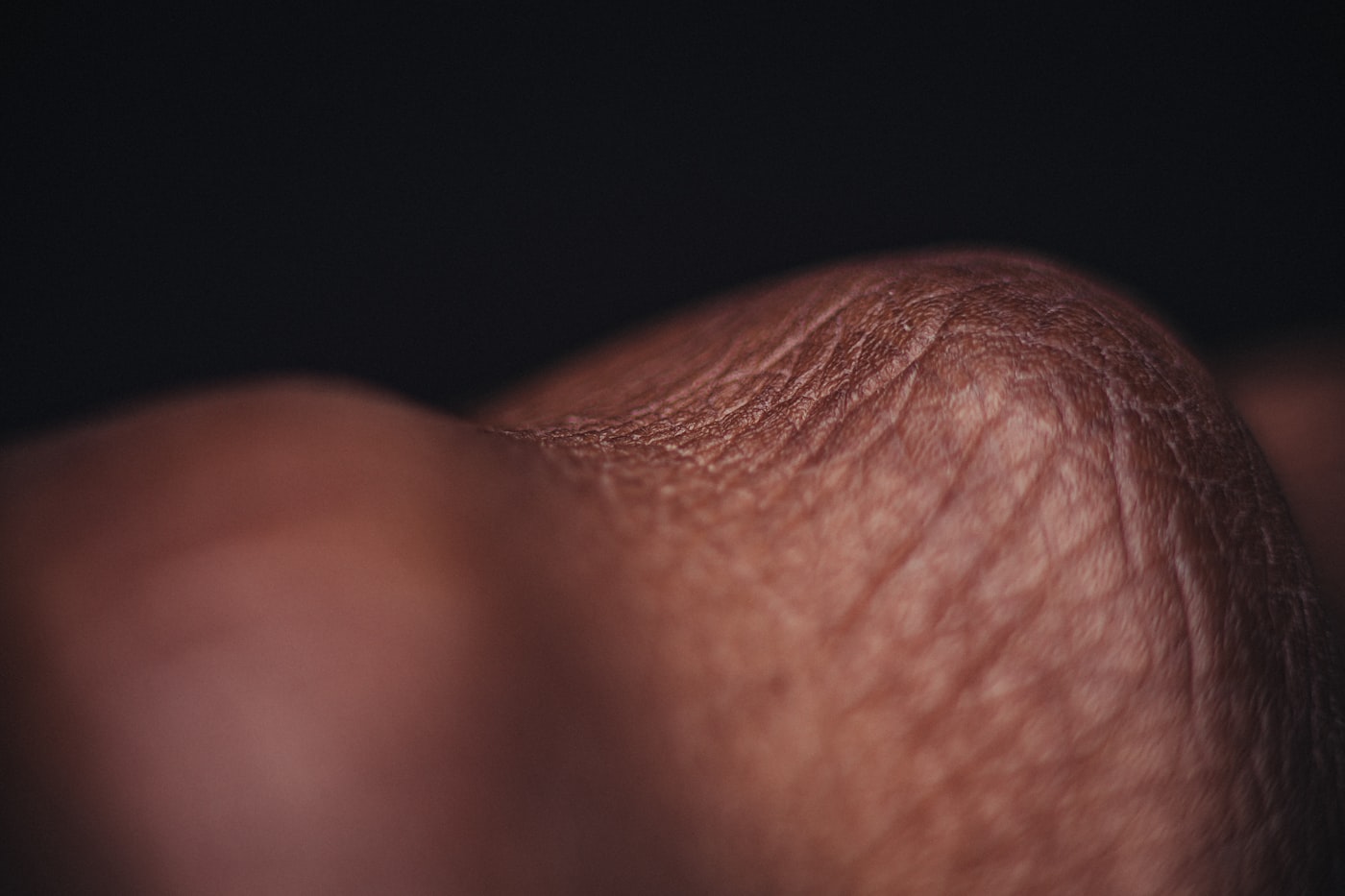 Skin Allergy